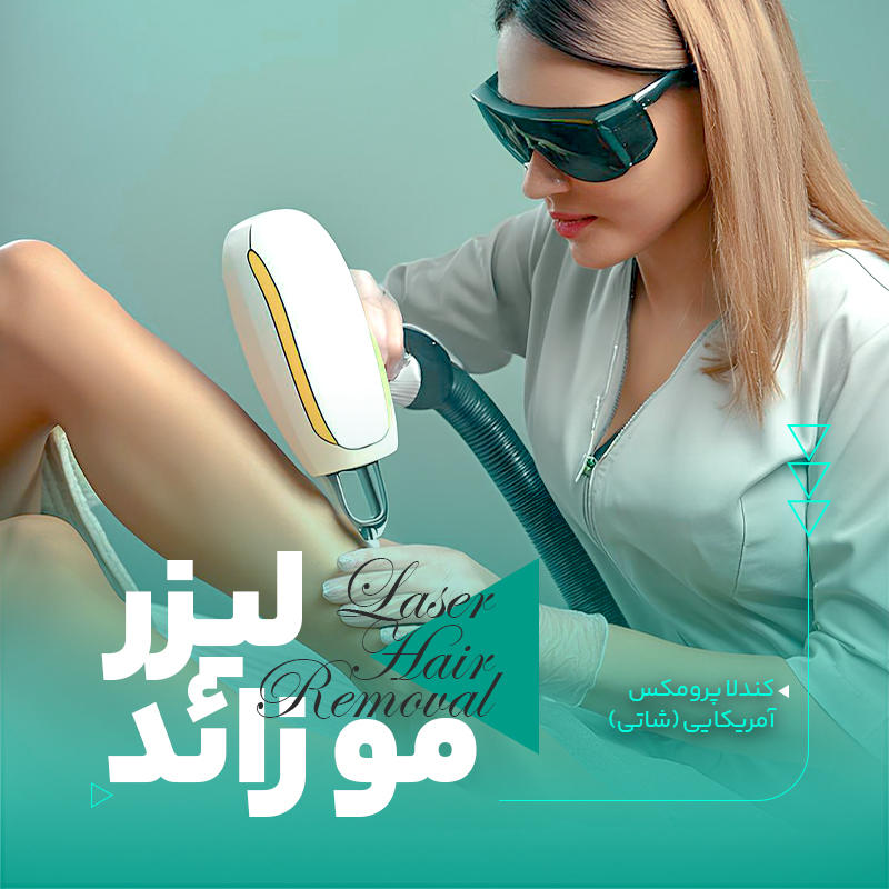 لیزر موهای زائد